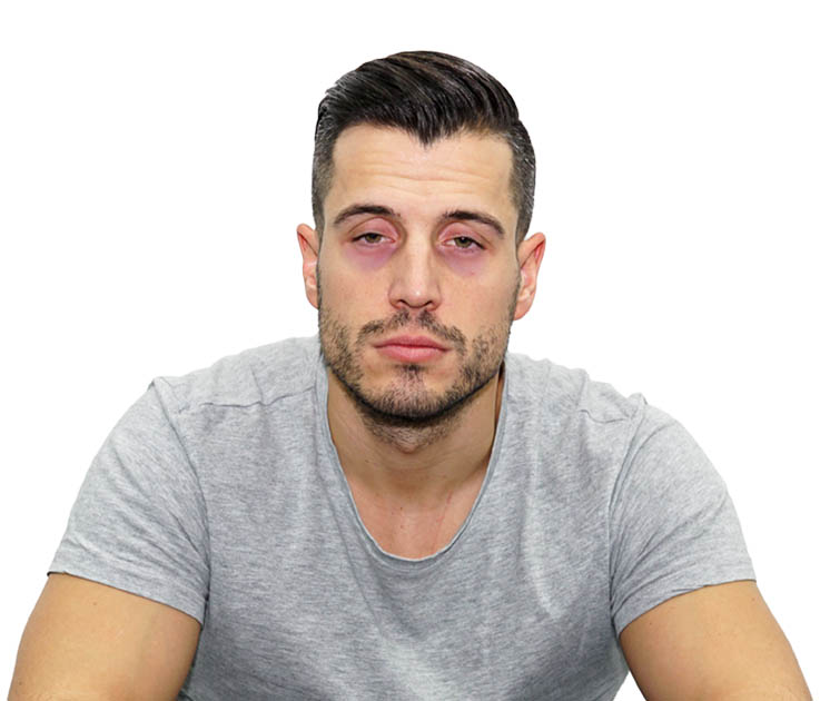 cos’è la stanchezza