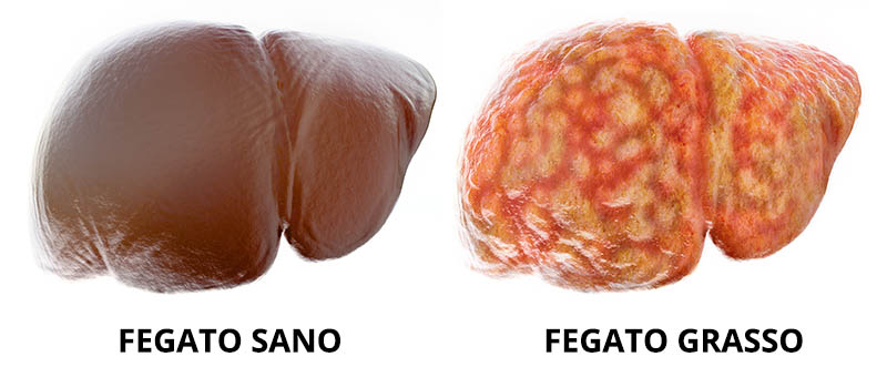 fegato sano - fegato grasso